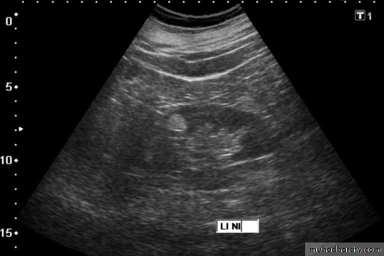 Genito-urinary System
