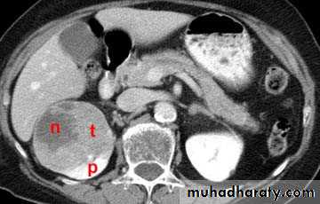 Genito-urinary System