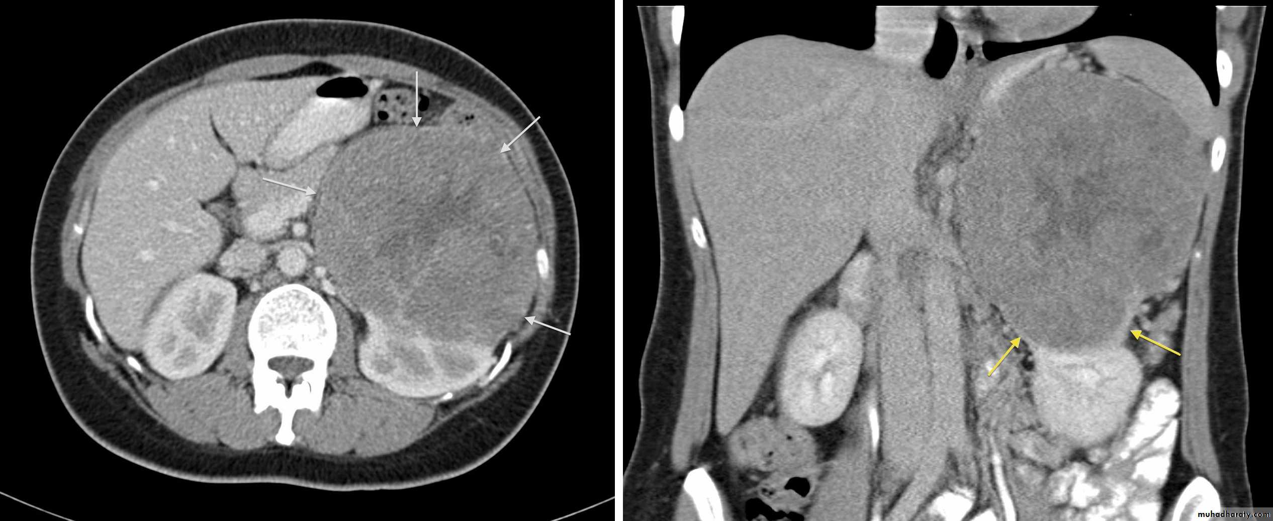 Genito-urinary System
