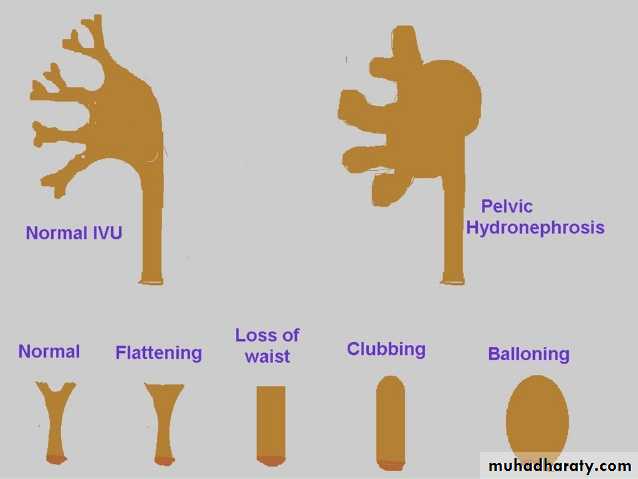 Genito-urinary System