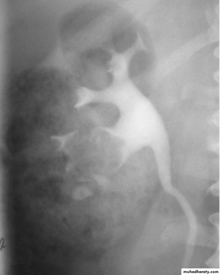 Genito-urinary System