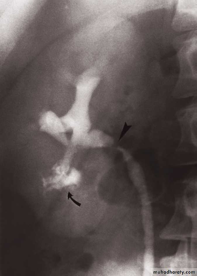 Genito-urinary System