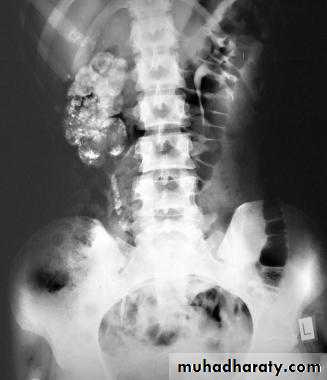 Genito-urinary System