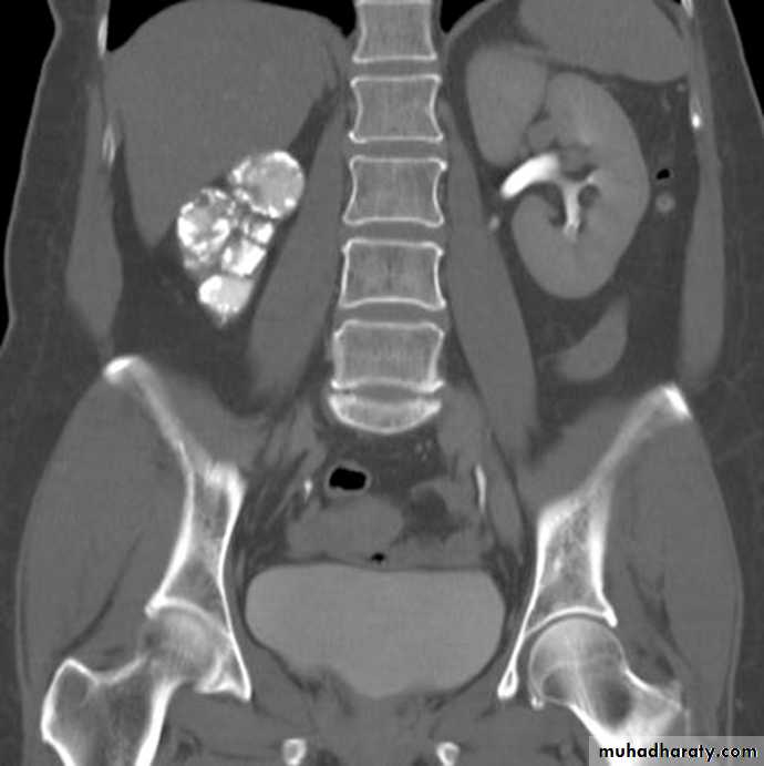 Genito-urinary System