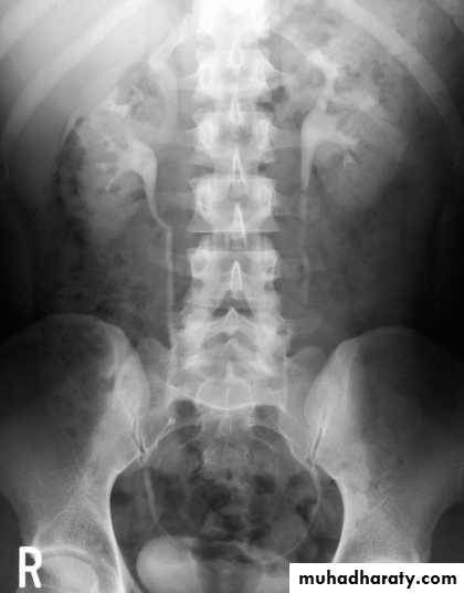 Genito-urinary System
