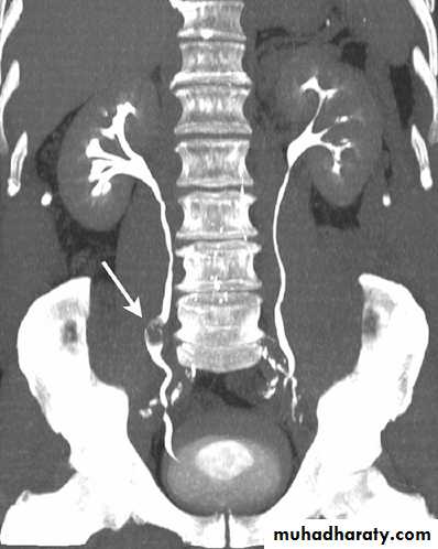Genito-urinary System