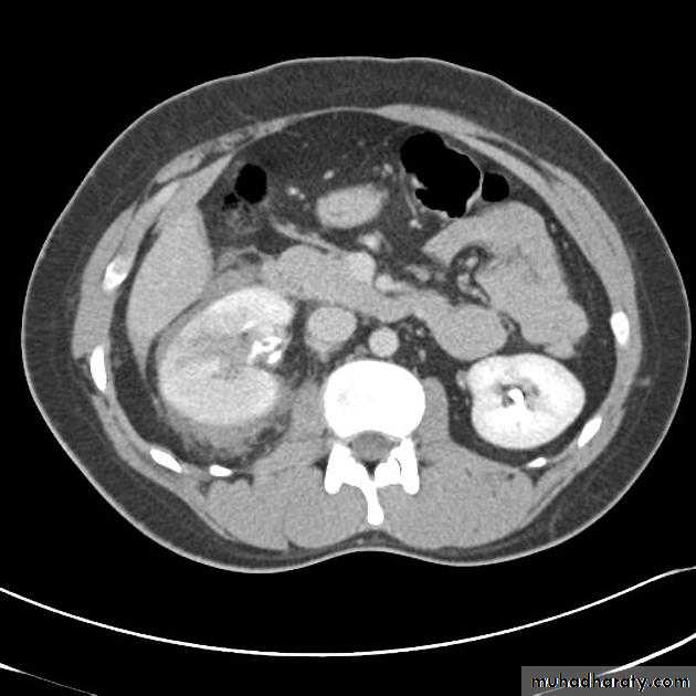 Genito-urinary System