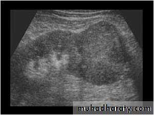 Genito-urinary System