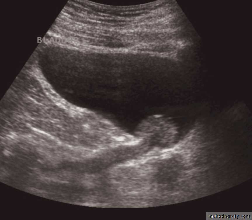 Genito-urinary System