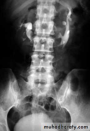 Genito-urinary System