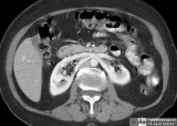 Genito-urinary System