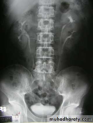 Genito-urinary System