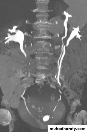 Genito-urinary System