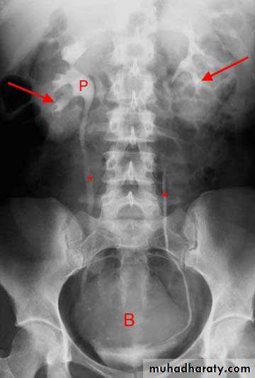 Genito-urinary System