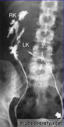Genito-urinary System