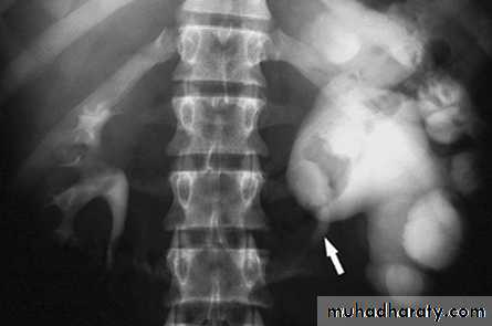 Genito-urinary System