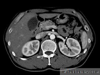Genito-urinary System