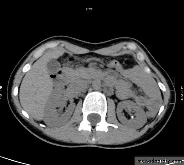 Genito-urinary System