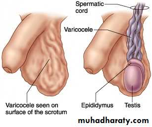 Disorders of the testis