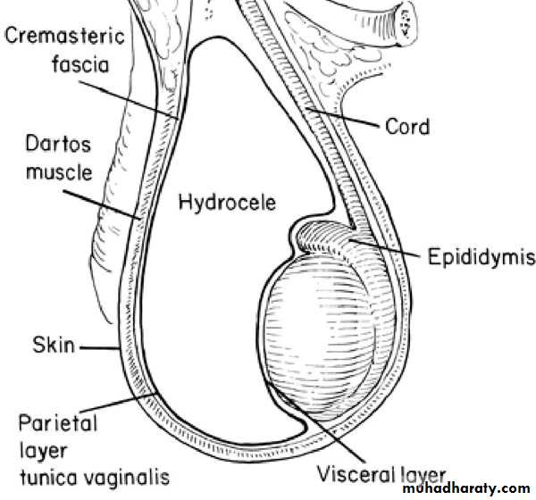 Disorders of the testis