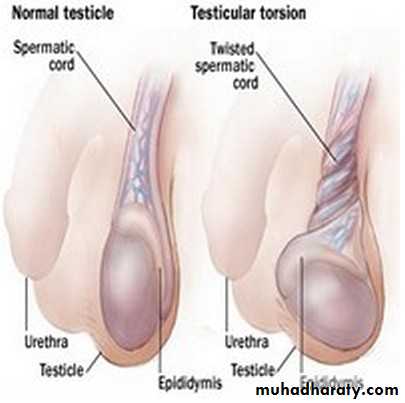 Disorders of the testis