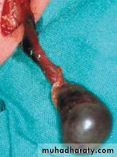 Disorders of the testis