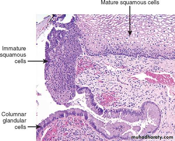 Cervix