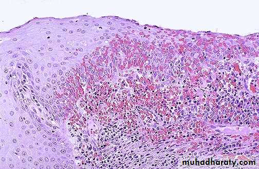 Cervix