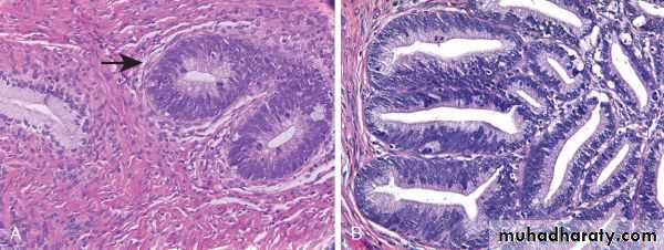 Cervix
