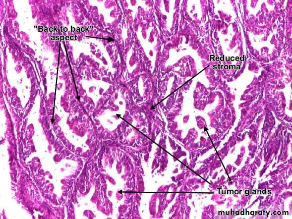 Uterus