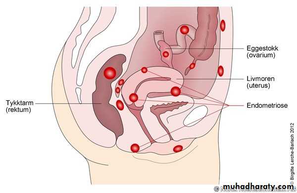 Uterus