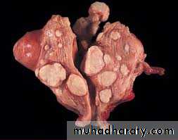Uterus