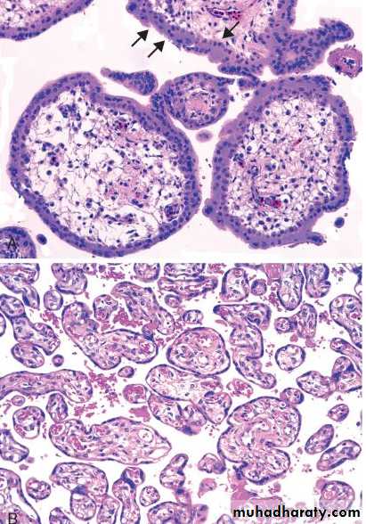 Fallopian Tubes