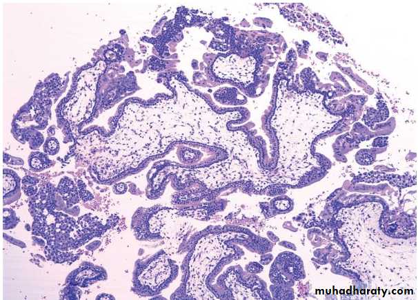 Fallopian Tubes