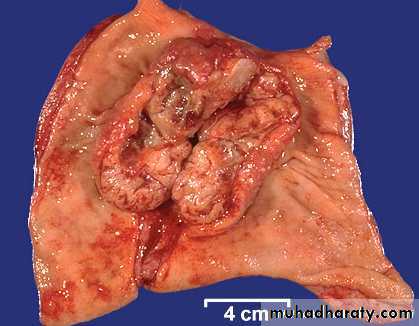 Stomach