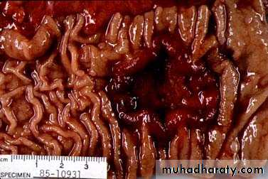 Stomach