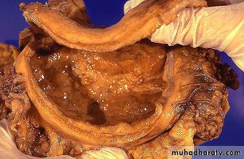 Stomach