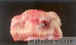Stomach