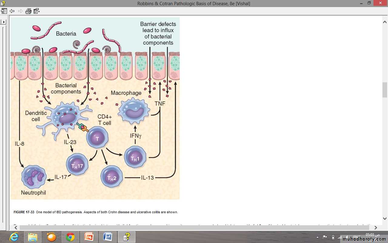 Inflammatory Intestinal Disease