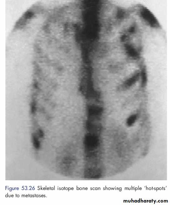 Breast
