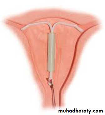 Family Planning
