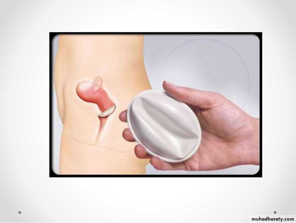 Family Planning