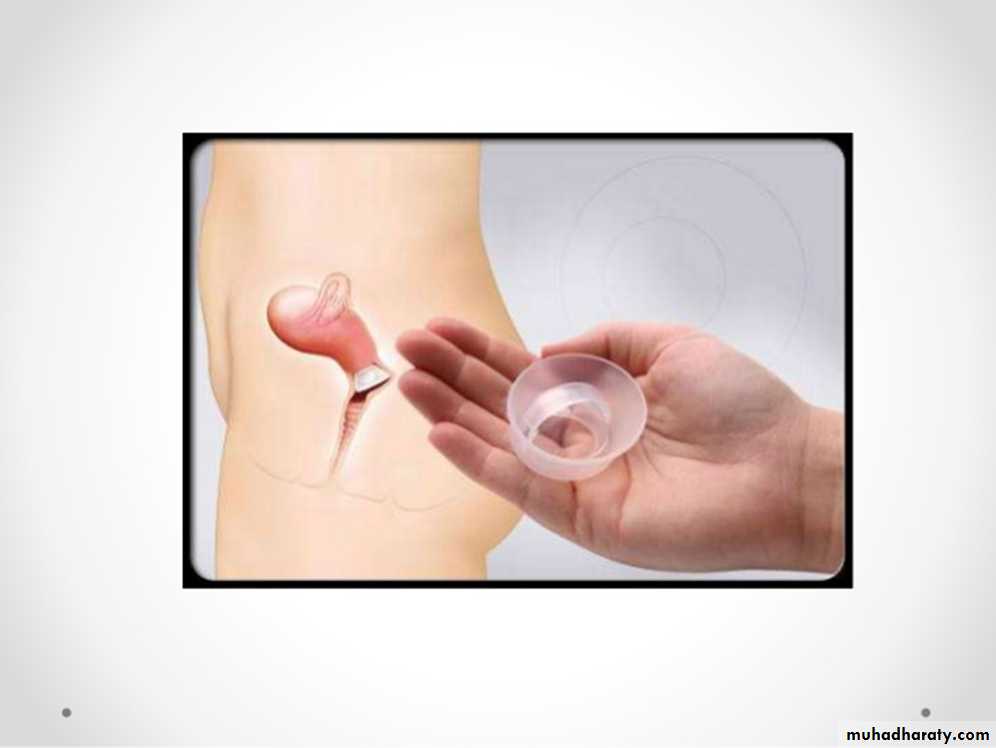 Family Planning