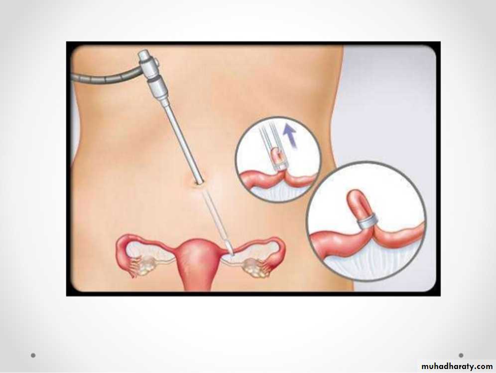 Family Planning