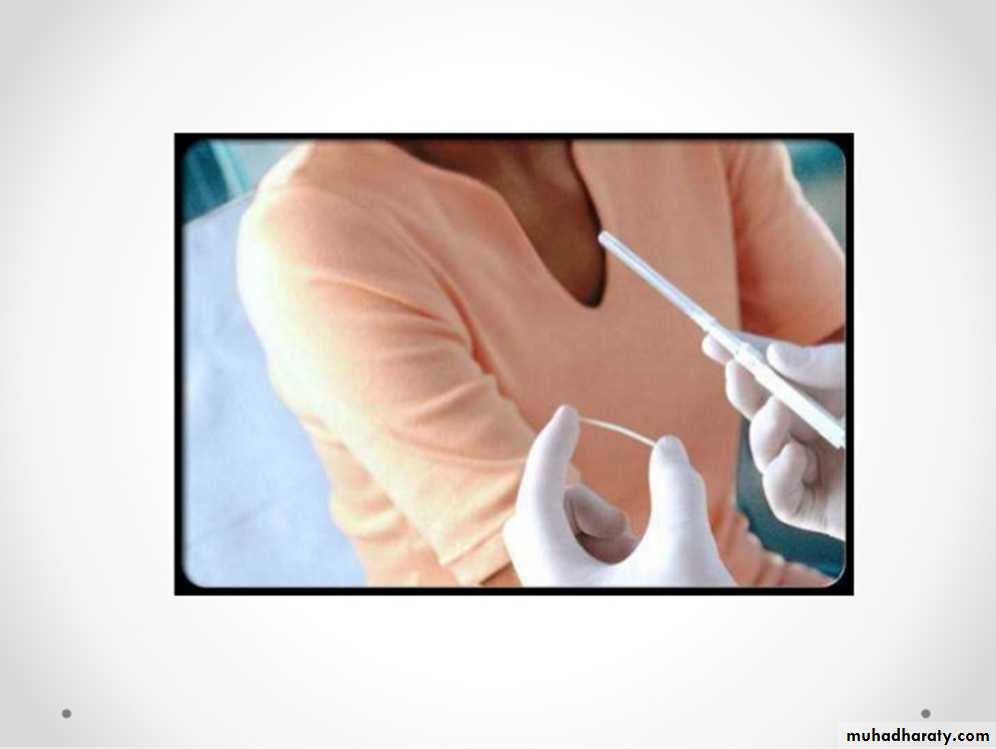 Family Planning