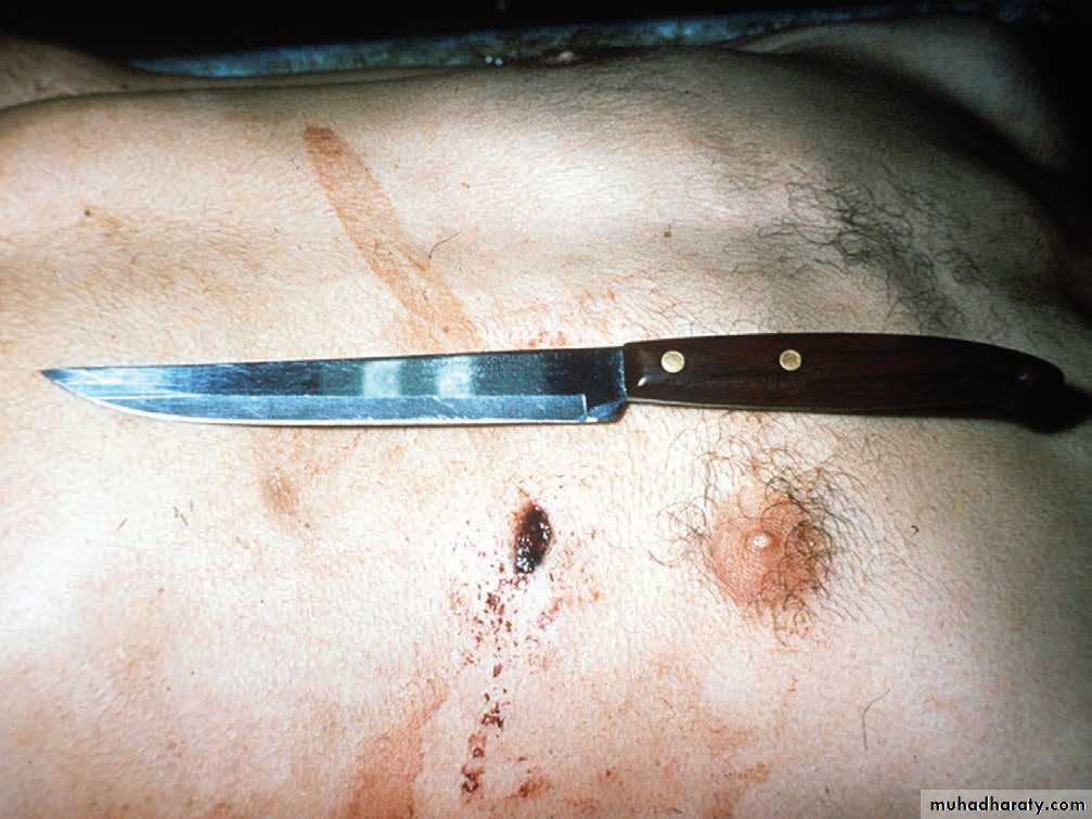 Wounds
