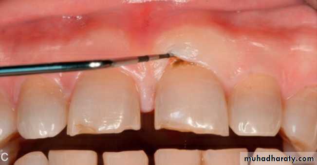 Clinical Periodontology