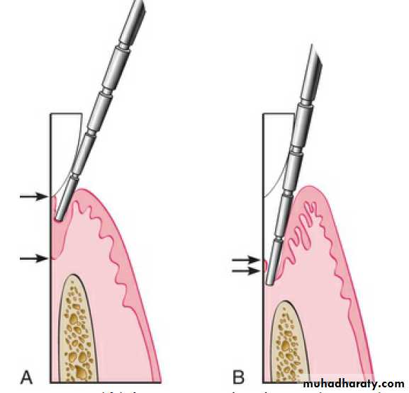 Clinical Periodontology