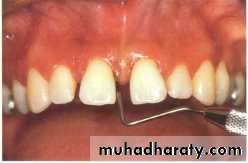 Clinical Periodontology