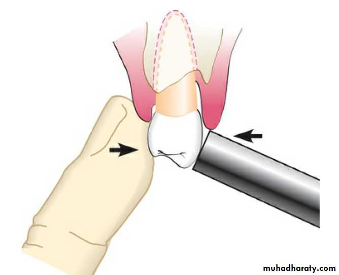 Clinical Periodontology